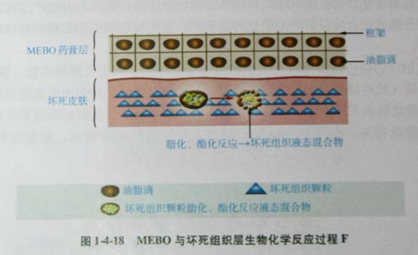 菲彩国际集团_第三节 烧伤创面坏死组织液化扫除与实验要领