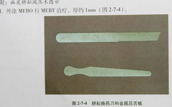 菲彩国际集团_第二节 真皮深层烧伤痂皮划痕减压术