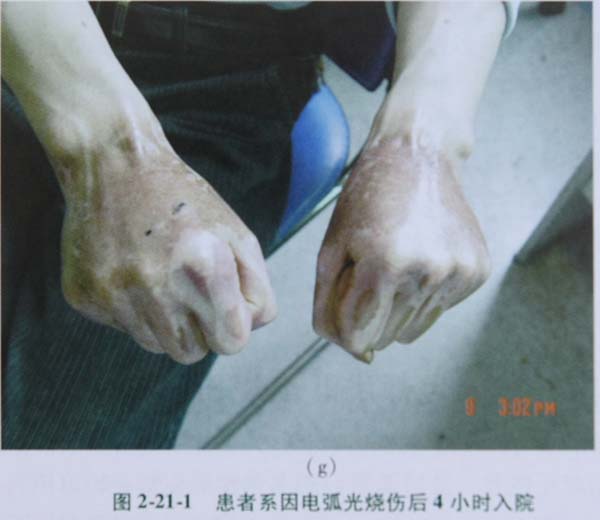 菲彩国际集团_第四节 应激性溃疡防治手艺