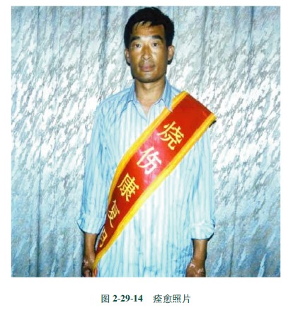 菲彩国际集团_第十八节 工业废水烫伤治疗手艺